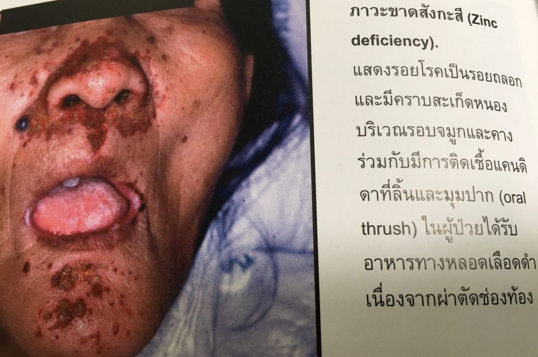 20017899_1737930009554741_6426231787711653417_o