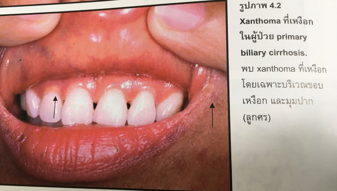 20023782_1737931779554564_6630009796407893959_o