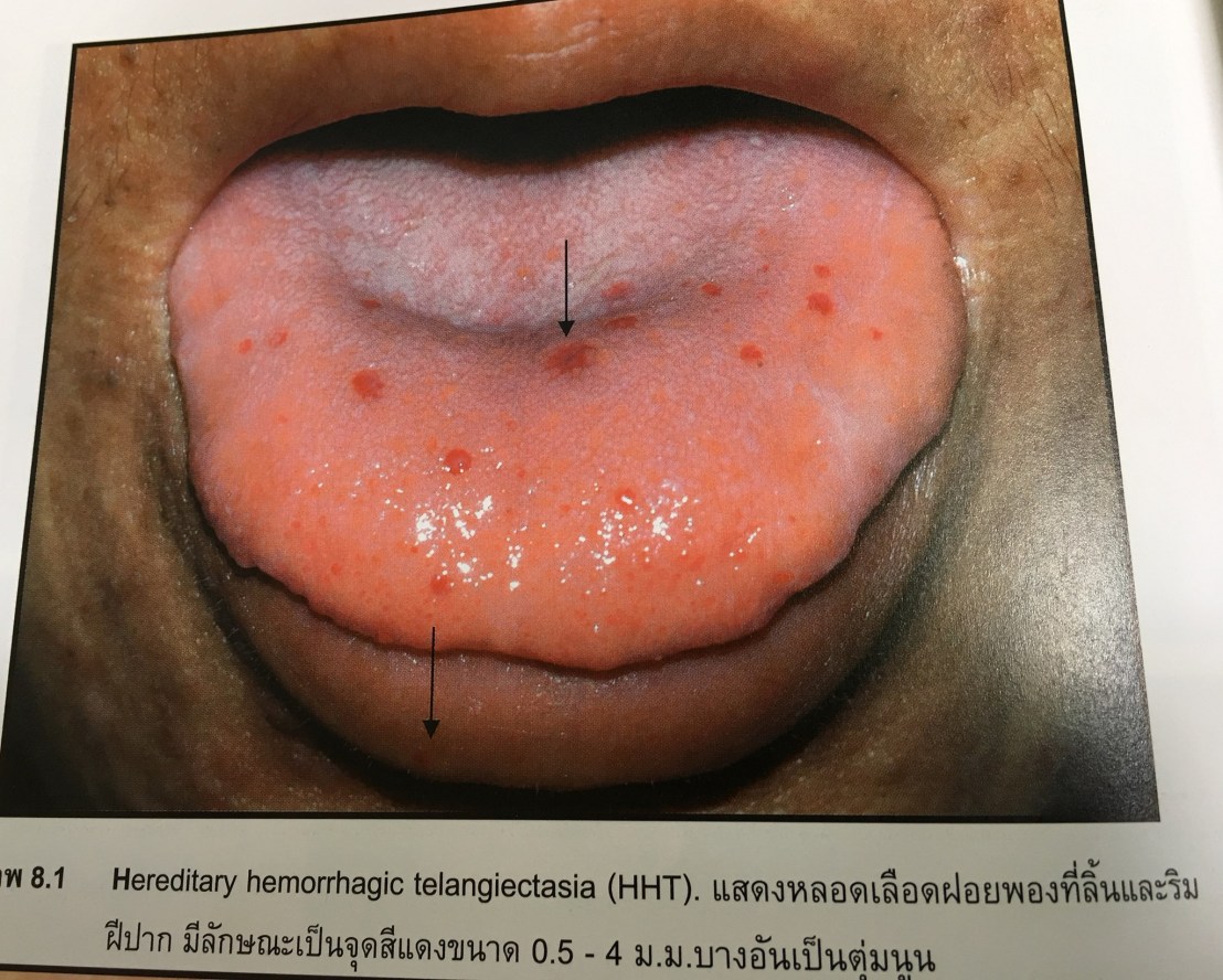 20023790_1737933702887705_7650339471692979915_o