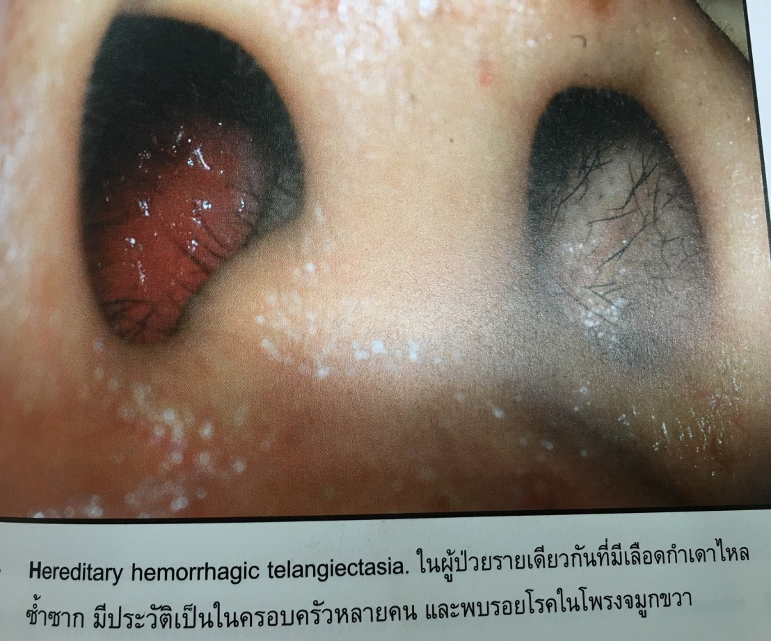 20024061_1737934472887628_2641511114232534173_o