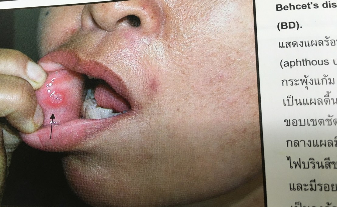 20024062_1737937832887292_4375121135730300882_o