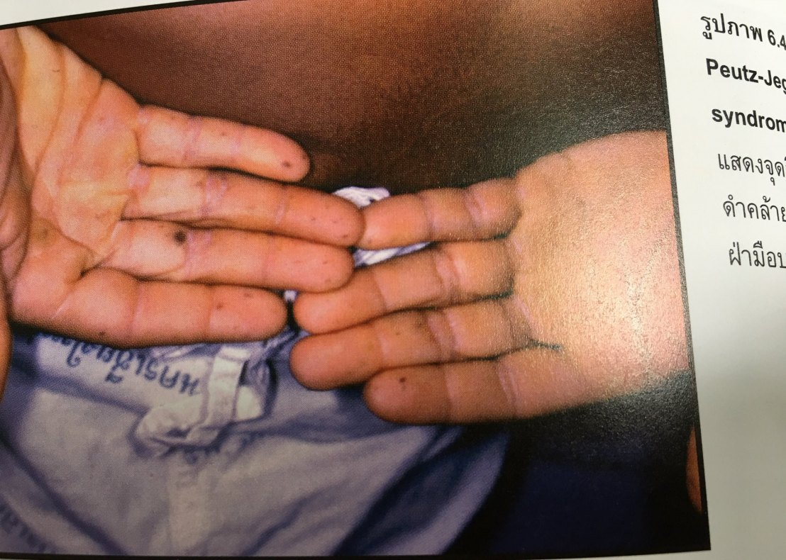 20024064_1737933199554422_5072893080391683102_o