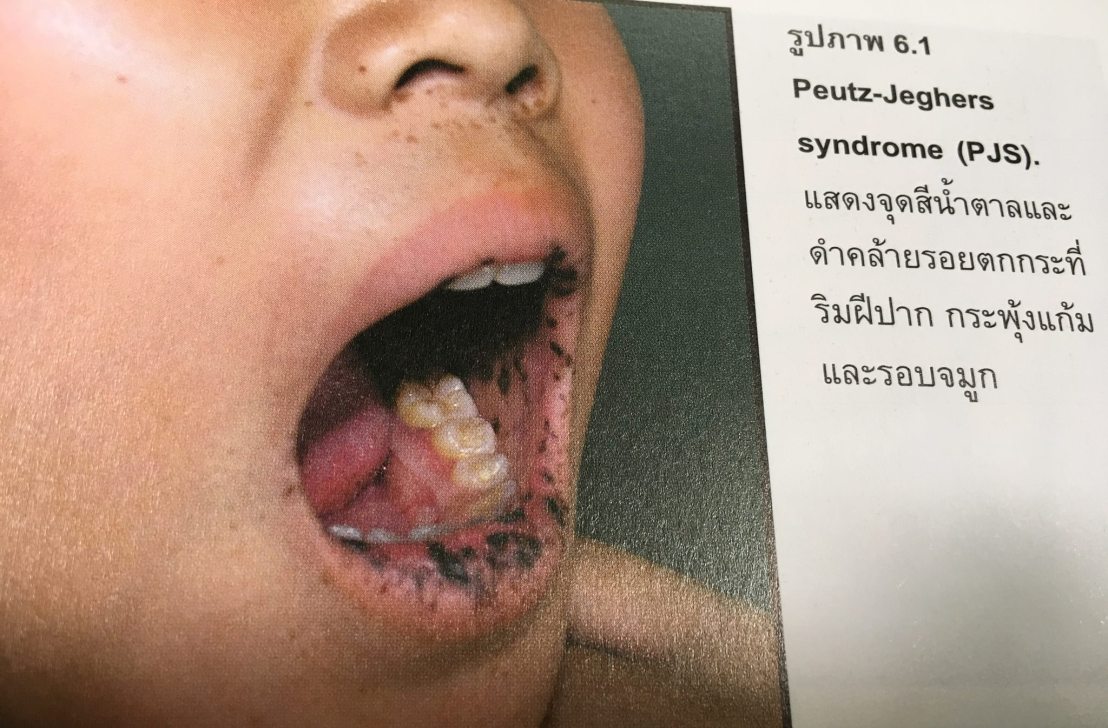 20024126_1737933056221103_8054854196748664202_o