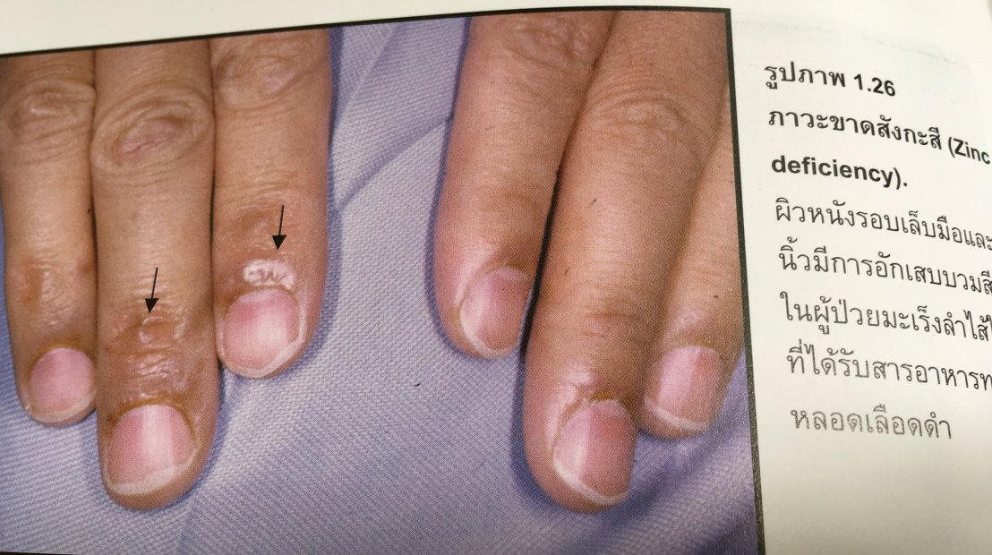 20045361_1737930129554729_1522691159000899996_o