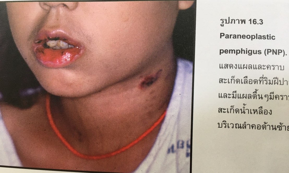 20045467_1737940069553735_8338754591521721795_o