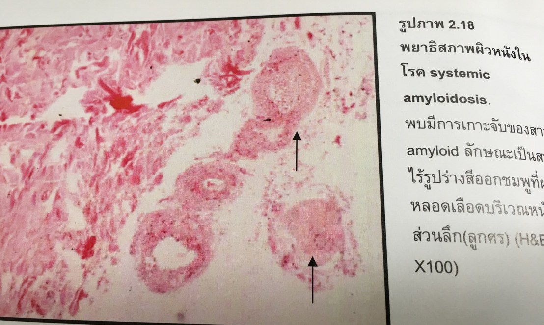 20045565_1737930536221355_3570539479961104349_o