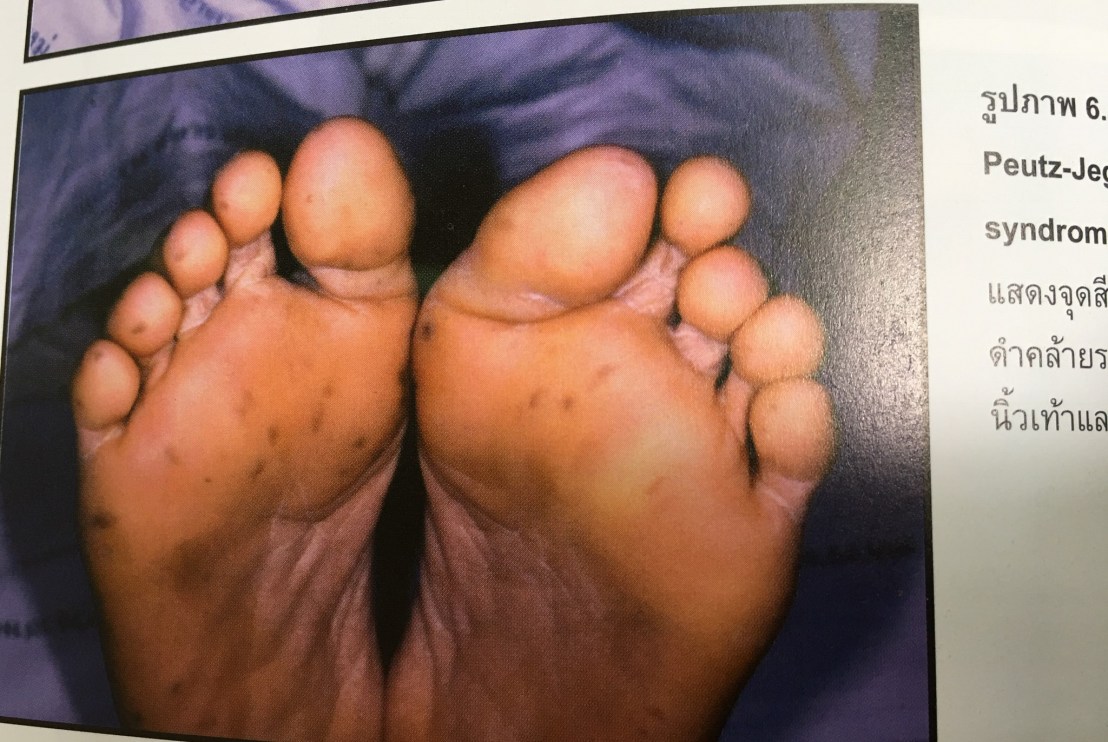 20045599_1737933302887745_5290632860676261292_o