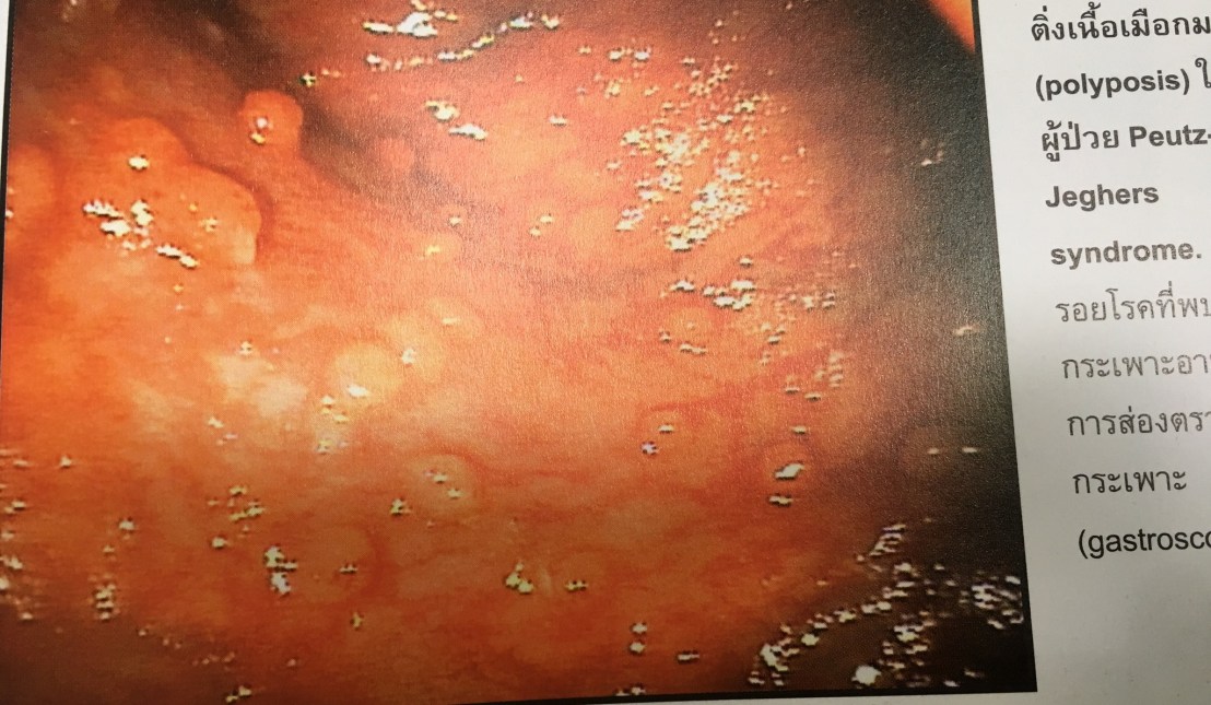 20045603_1737933436221065_7459545102175432405_o