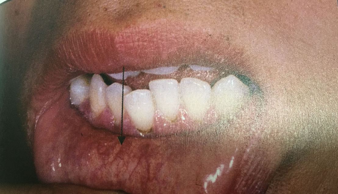 20045603_1737935216220887_8189255929881623473_o