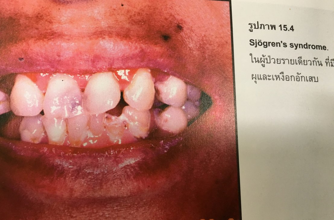 20045648_1737939106220498_2335676946641583951_o