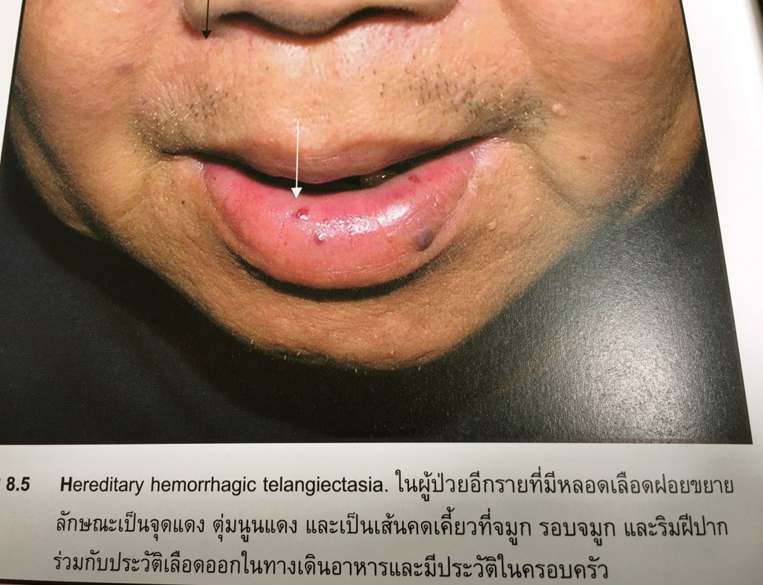 20116957_1737934532887622_1480769322447250504_o