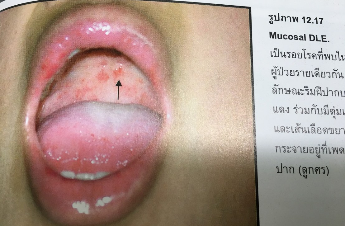 20117143_1737936366220772_789496246715357517_o